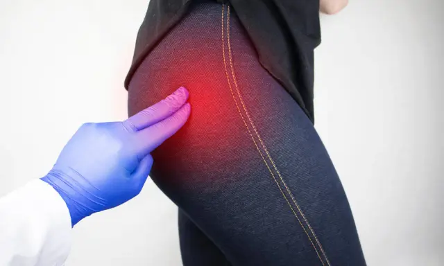 Mano con guanto blu indica un'area rossa di dolore sull'anca, suggerendo irritazione tra le natiche.