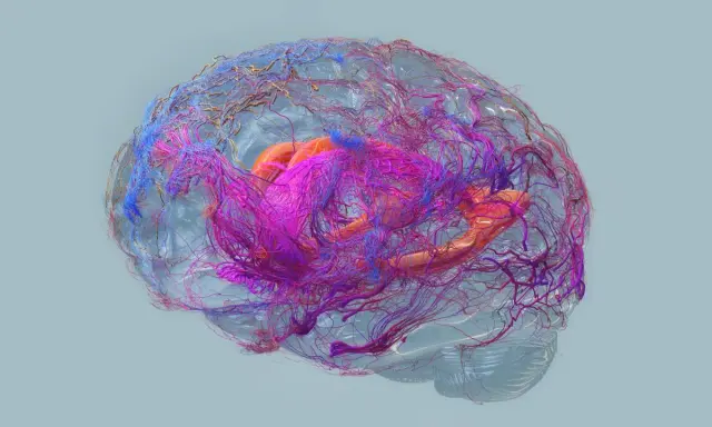 Cervello umano con vasi sanguigni colorati, che simboleggiano la complessità e i potenziali **alzheimer sintomi finali**.