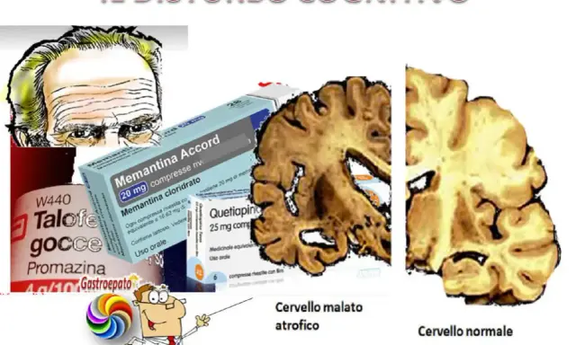 Illustrazione di un cervello atrofico e uno normale, farmaci e un medico che indica il decadimento cognitivo lieve.