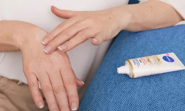 Mani che si massaggiano crema idratante per alleviare il prurito alle mani. Tubetto di Nivea Luminous 630 in primo piano.