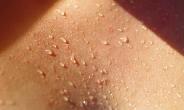 Goccioline di sudore brillano sulla pelle, un segno di calore e attività. Potrebbe essere l'inizio di un eritema da sudore.