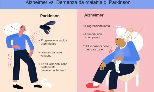 Confronto tra Parkinson e Alzheimer: progressione, sintomi e allucinazioni. Differenza tra parkinson e alzheimer illustrata con icone.