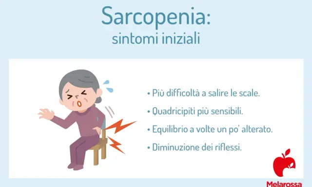 Anziana con difficoltà a sedersi, sintomi iniziali di sarcopenia: fatica a salire le scale, quadricipiti sensibili, equilibrio alterato, riflessi diminuiti.