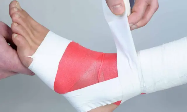 Applicazione di bendaggio ossido di zinco sulla caviglia per supporto e protezione.