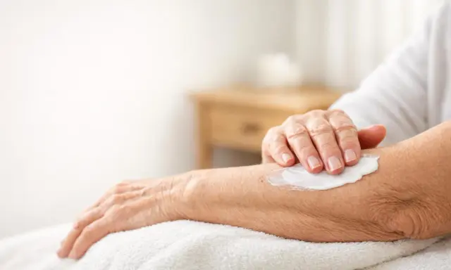 Mano anziana applica crema idratante su un braccio per alleviare i pruriti sul corpo.