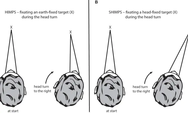 Il test **head impulse test** confronta la fissazione di un bersaglio fisso (A) con quella di un bersaglio mobile con la testa (B) durante una rotazione.
