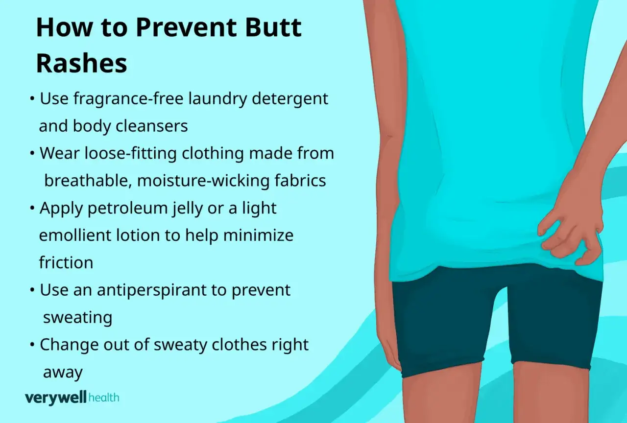 Prevenire l'irritazione piega sedere: consigli su detergenti, abbigliamento traspirante e creme per ridurre l'attrito.