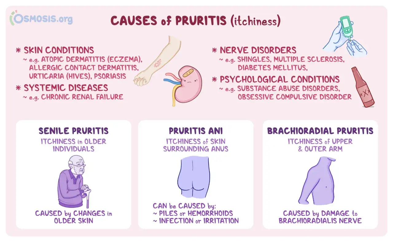 Le cause dei pruriti sul corpo includono condizioni della pelle, malattie sistemiche, disturbi nervosi e psicologici.