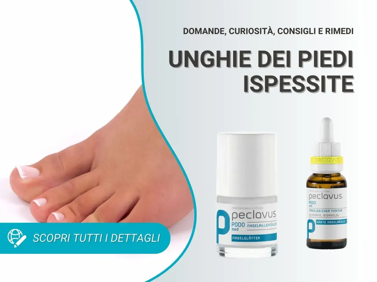 Piedi con unghie ispessite, prodotti per la cura delle unghie dei piedi.