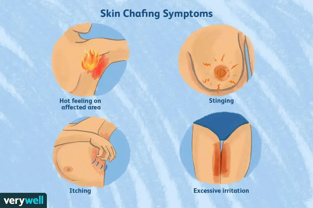 Sintomi di irritazione da sfregamento: bruciore, prurito, pizzicore e arrossamento in diverse aree del corpo.