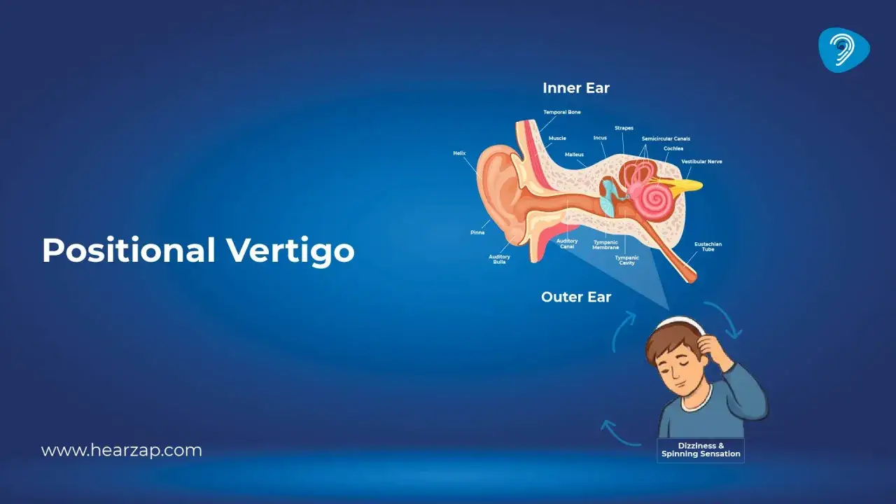Illustrazione anatomica dell'orecchio interno e esterno, che spiega i giramenti di testa a letto.