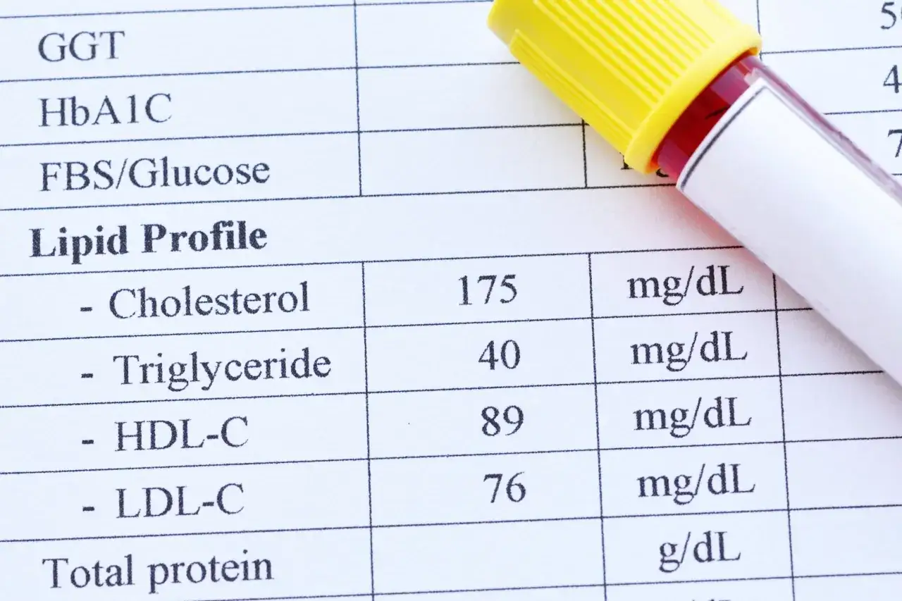 Referto analisi con profilo lipidico: colesterolo 175, trigliceridi 40, HDL-C 89, LDL-C 76. Ottimi trigliceridi bassi!