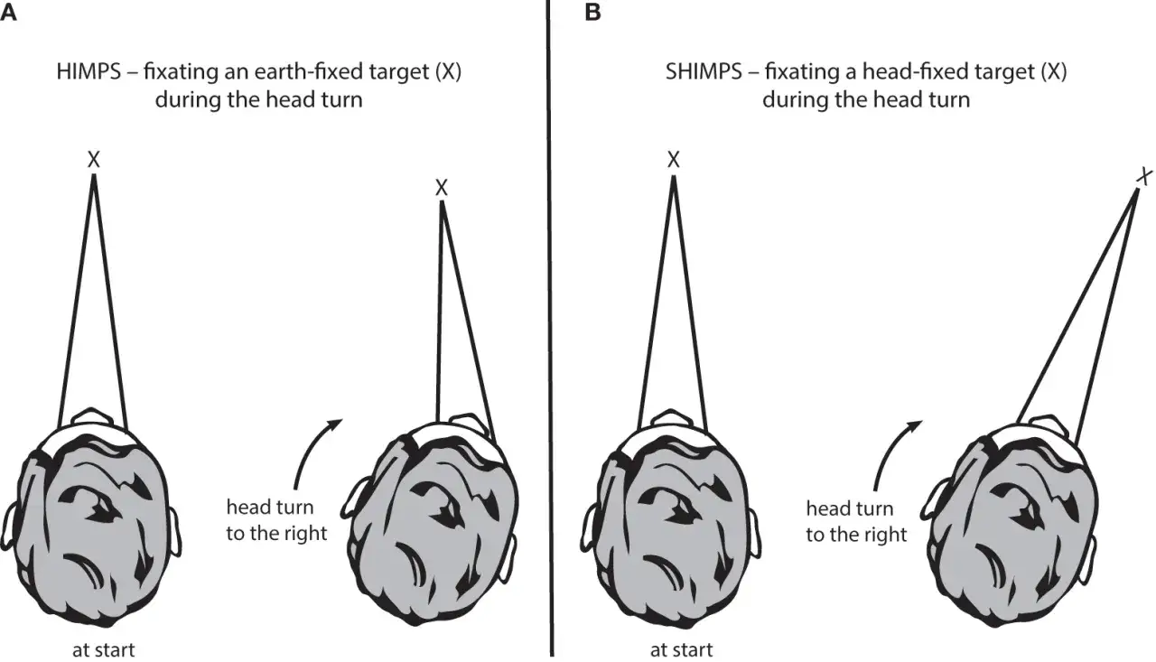 Il test head impulse mostra come gli occhi mantengono la fissazione su un bersaglio fisso (A) o mobile con la testa (B) durante un rapido movimento del capo.