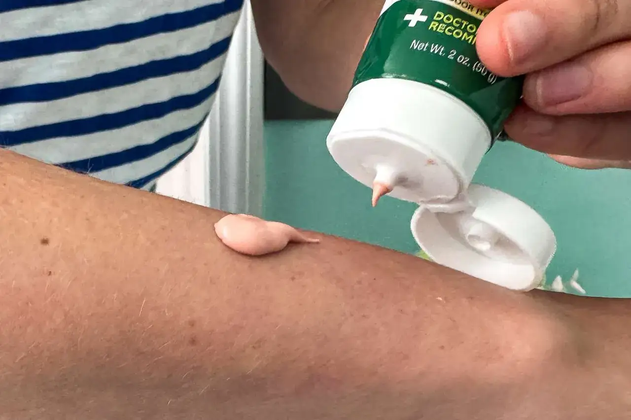 Una persona applica un antistaminico per prurito sul braccio, alleviando il fastidio.