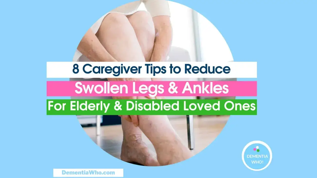 Gambe gonfie anziani: scopri rimedi e consigli per alleviare il gonfiore e migliorare il benessere.