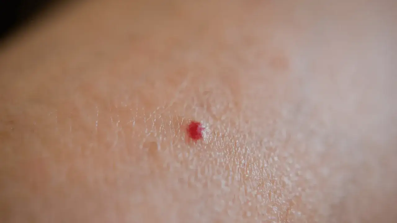 Piccola macchia rossa sulla pelle, un dettaglio che non dà fastidio.