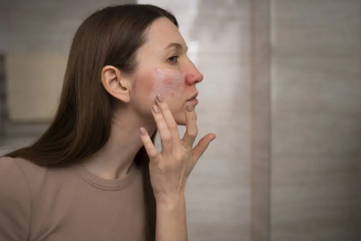 Donna applica crema su guance arrossate, cercando sollievo dalle piaghe della pelle.