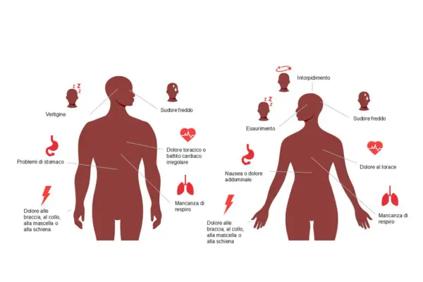 Sintomi infarto donna: vertigini, sudore freddo, dolore al torace, nausea, affanno, dolore a braccia, collo, mascella o schiena.