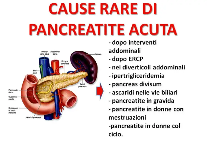 Anatomia del pancreas e cause rare di pancreatite acuta: interventi addominali, ipertrigliceridemia, pancreatite in gravidanza e donne.