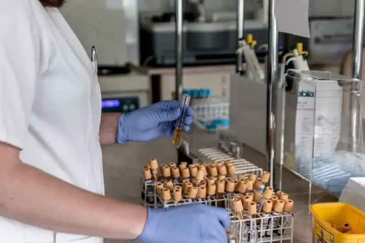 Analisi in laboratorio per capire come abbassare le transaminasi velocemente. Esami del sangue in provette.